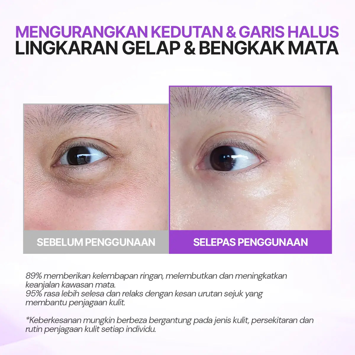 SEYOUL Eye Cream with Cold Ion Vibration Massage