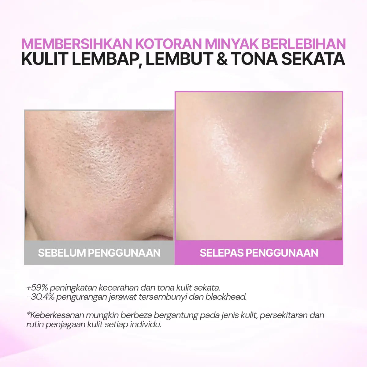 SEYOUL Toner Pad