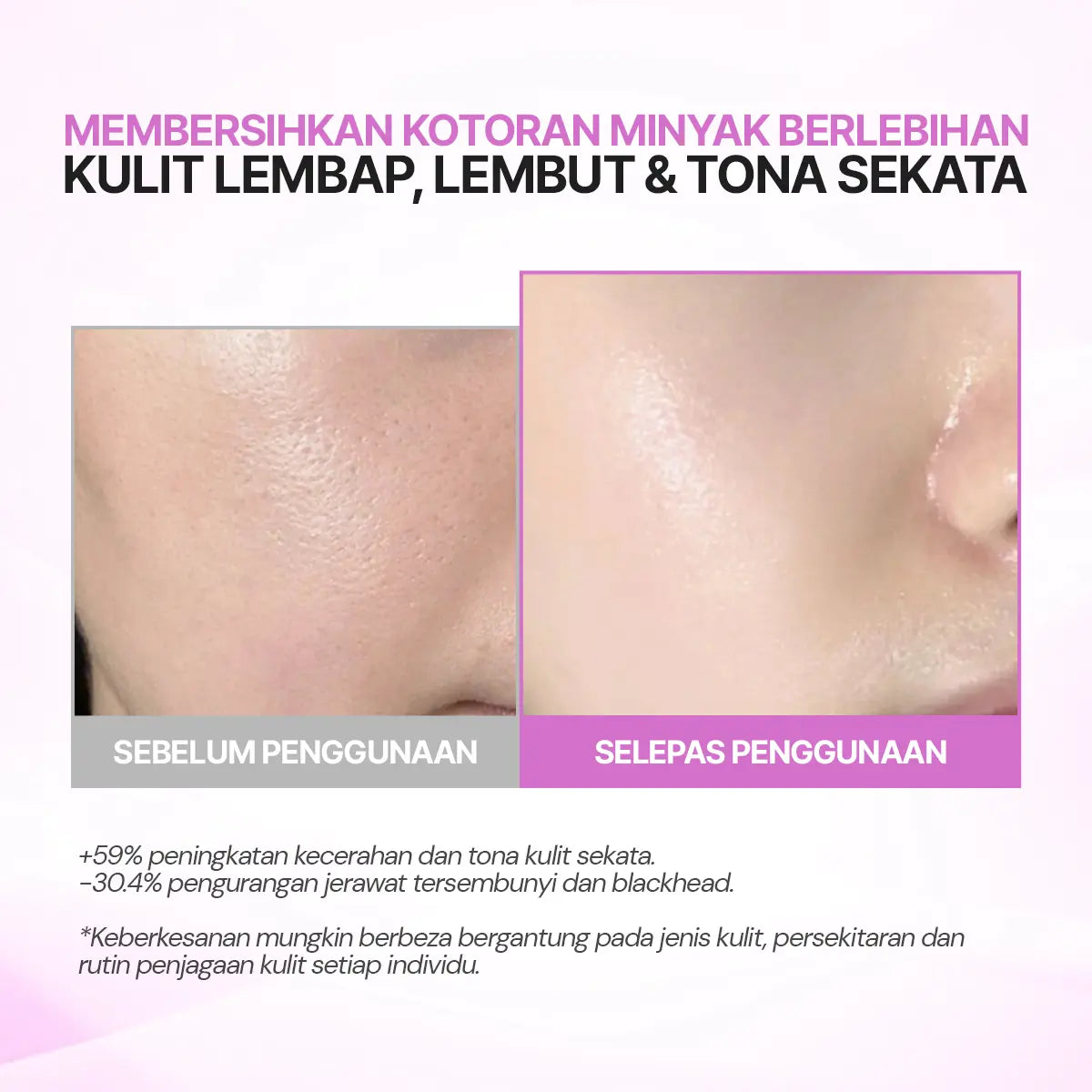 SEYOUL Toner Pad