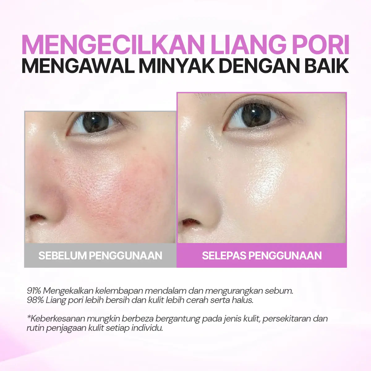 SEYOUL Bubble Toner