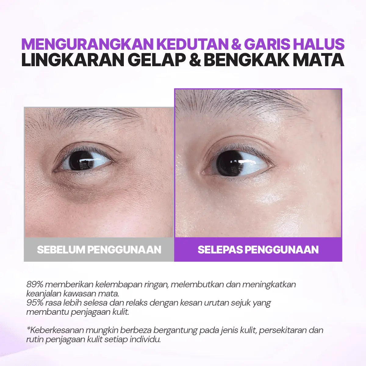 SEYOUL Eye Cream with Cold Ion Vibration Massage
