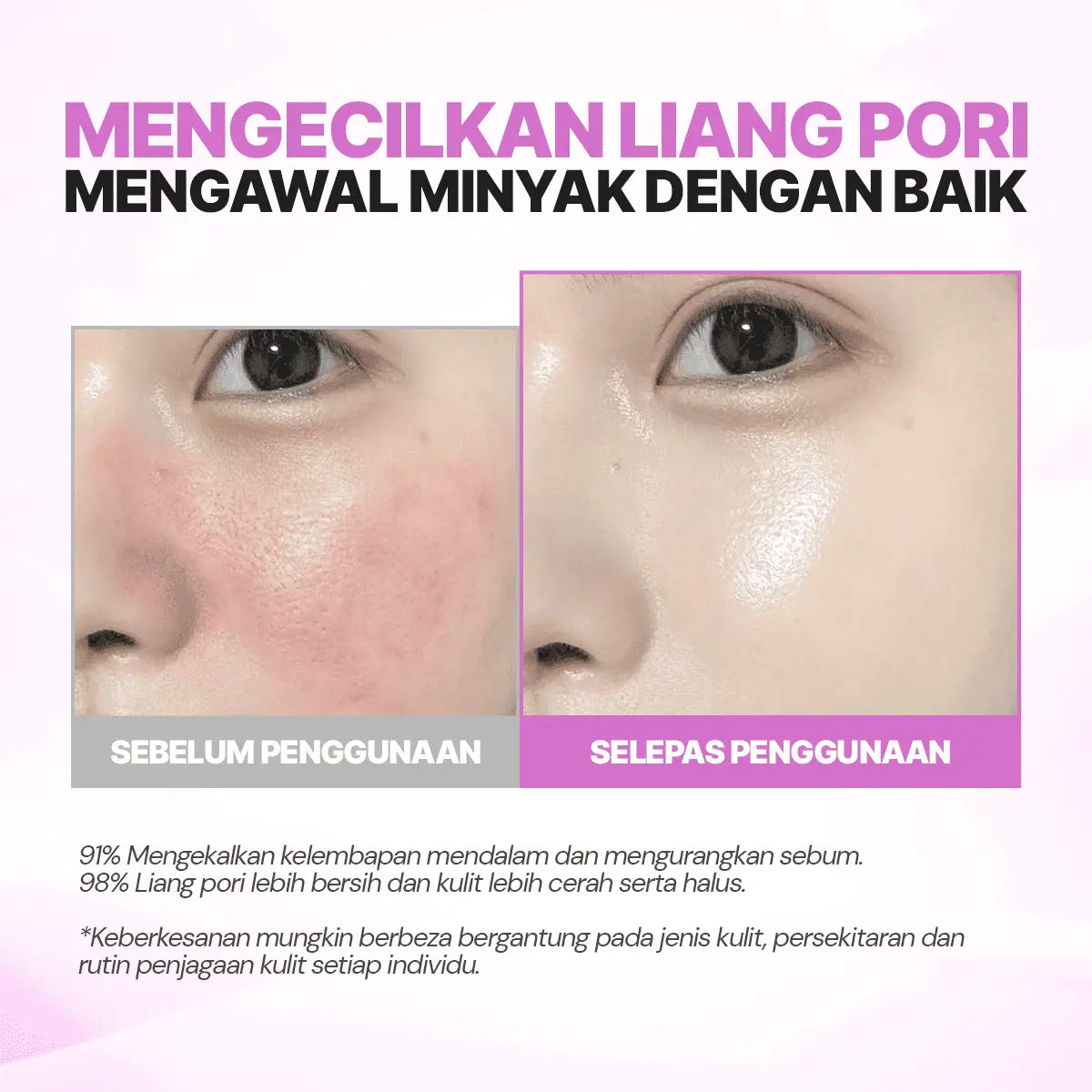 SEYOUL Bubble Toner