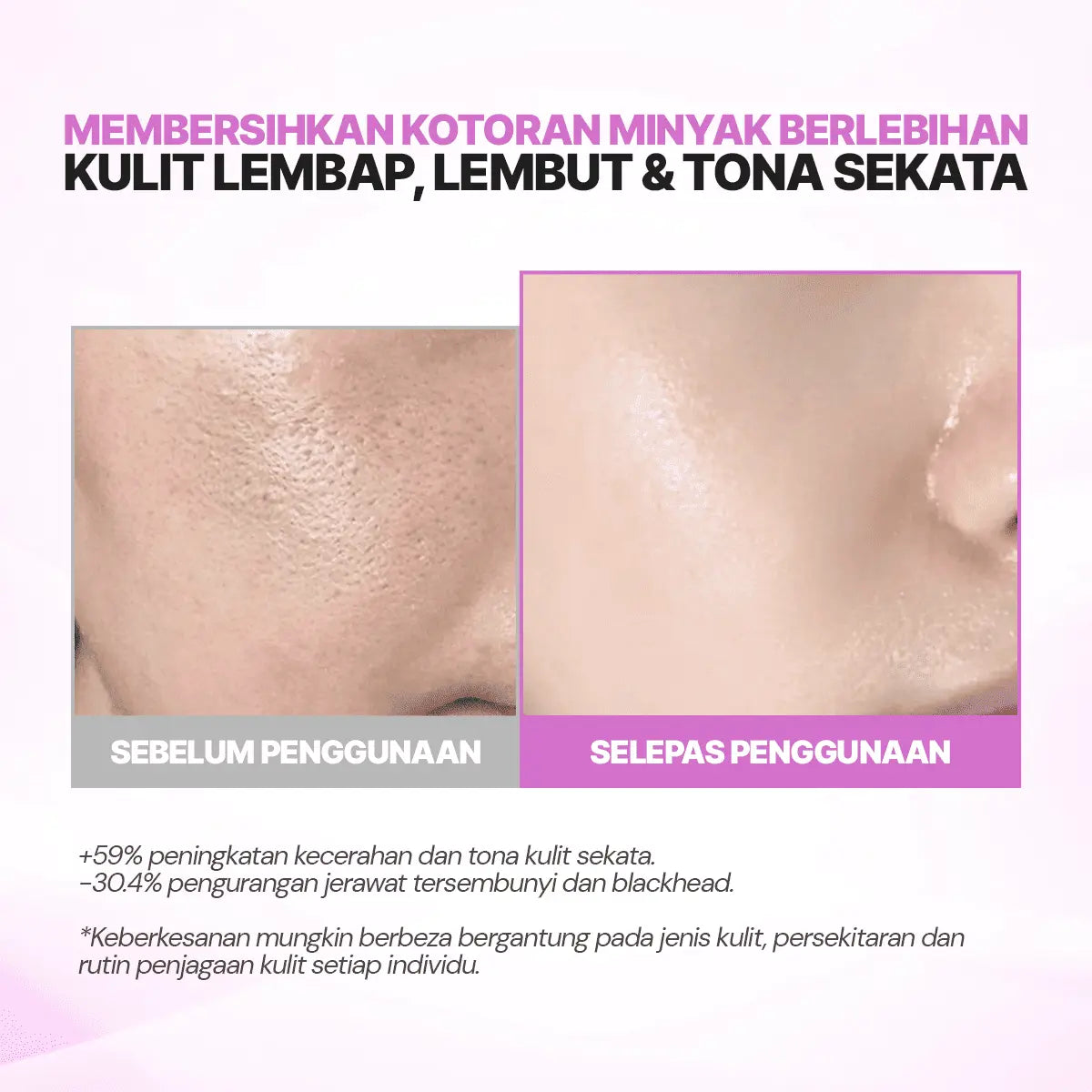 SEYOUL Toner Pad
