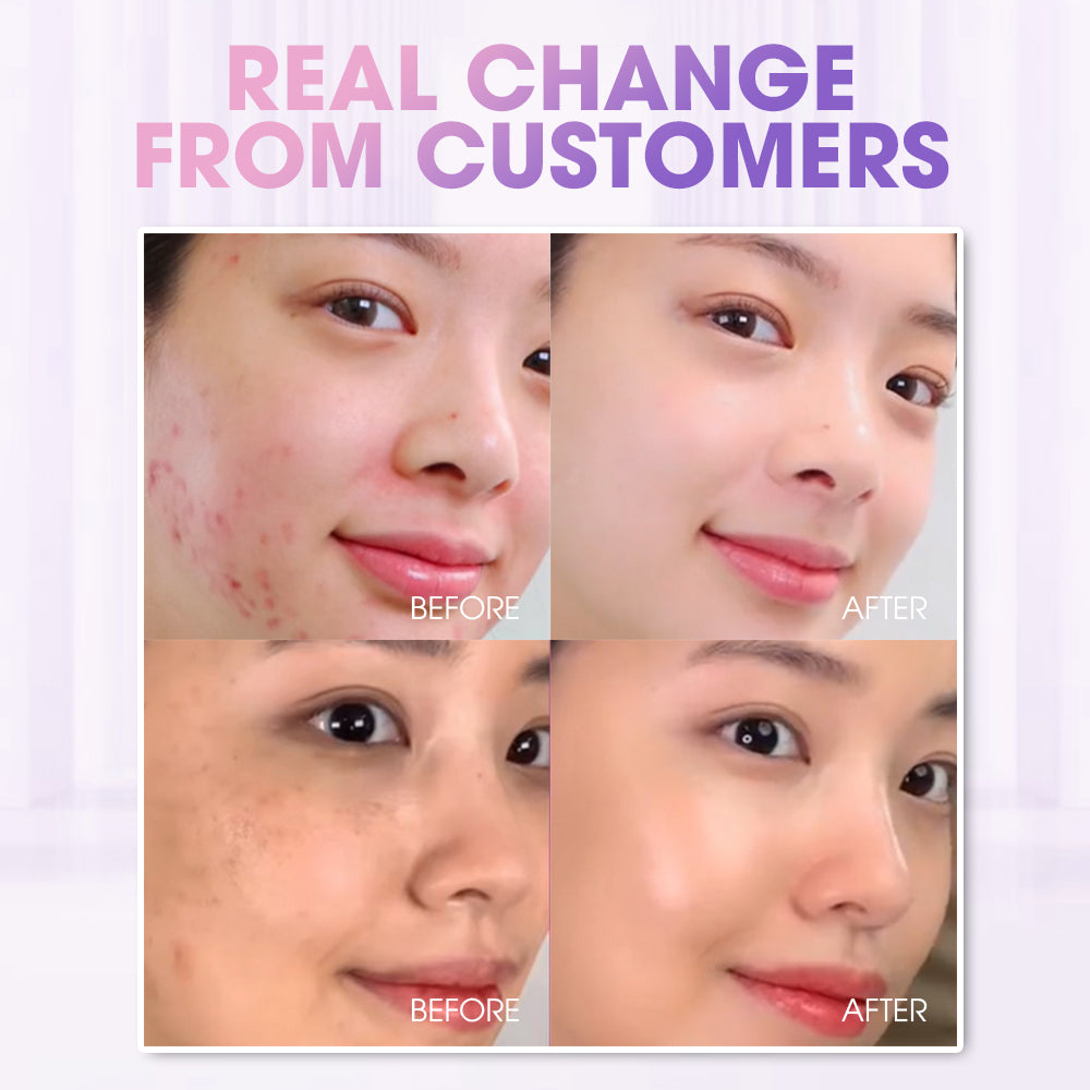 Seyoul Bubble Toner