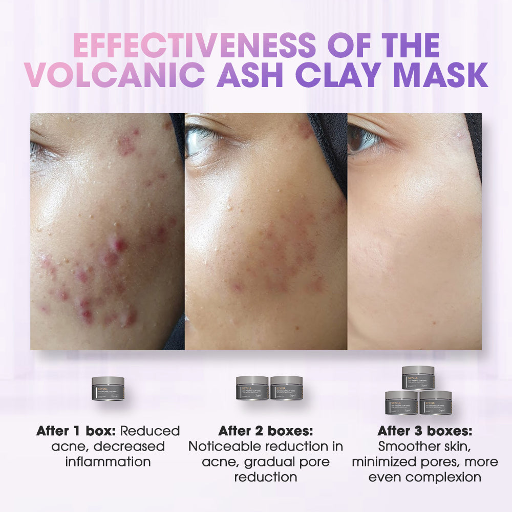 Seyoul Volcanic Ash Clay Mask