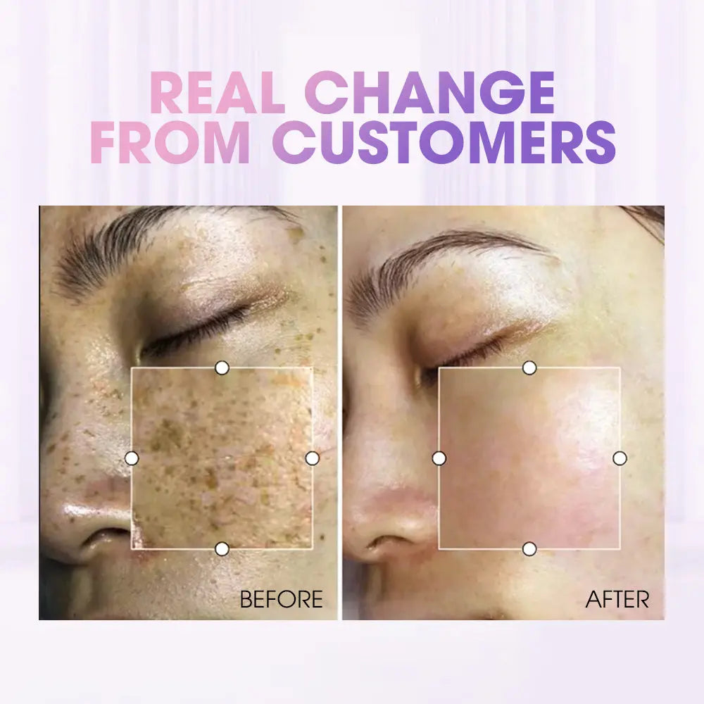 SEYOUL Advanced Serum + Melatonin Night Cream [FREE Gift RM80]