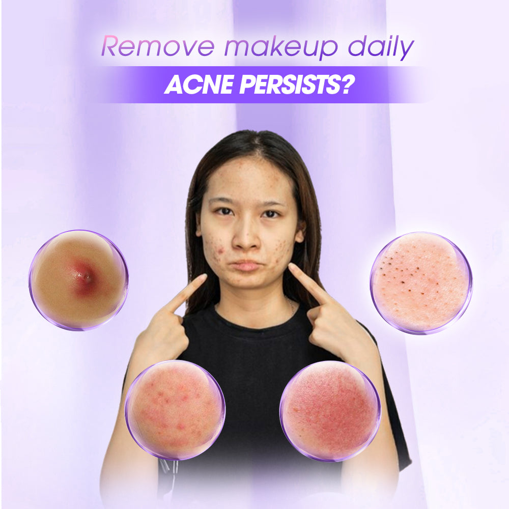 SEYOUL Cleansing Oil