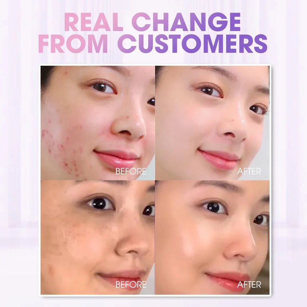 SEYOUL Bubble Toner - Seyoul - Malaysia OfficialTMDT - 1P(0330)