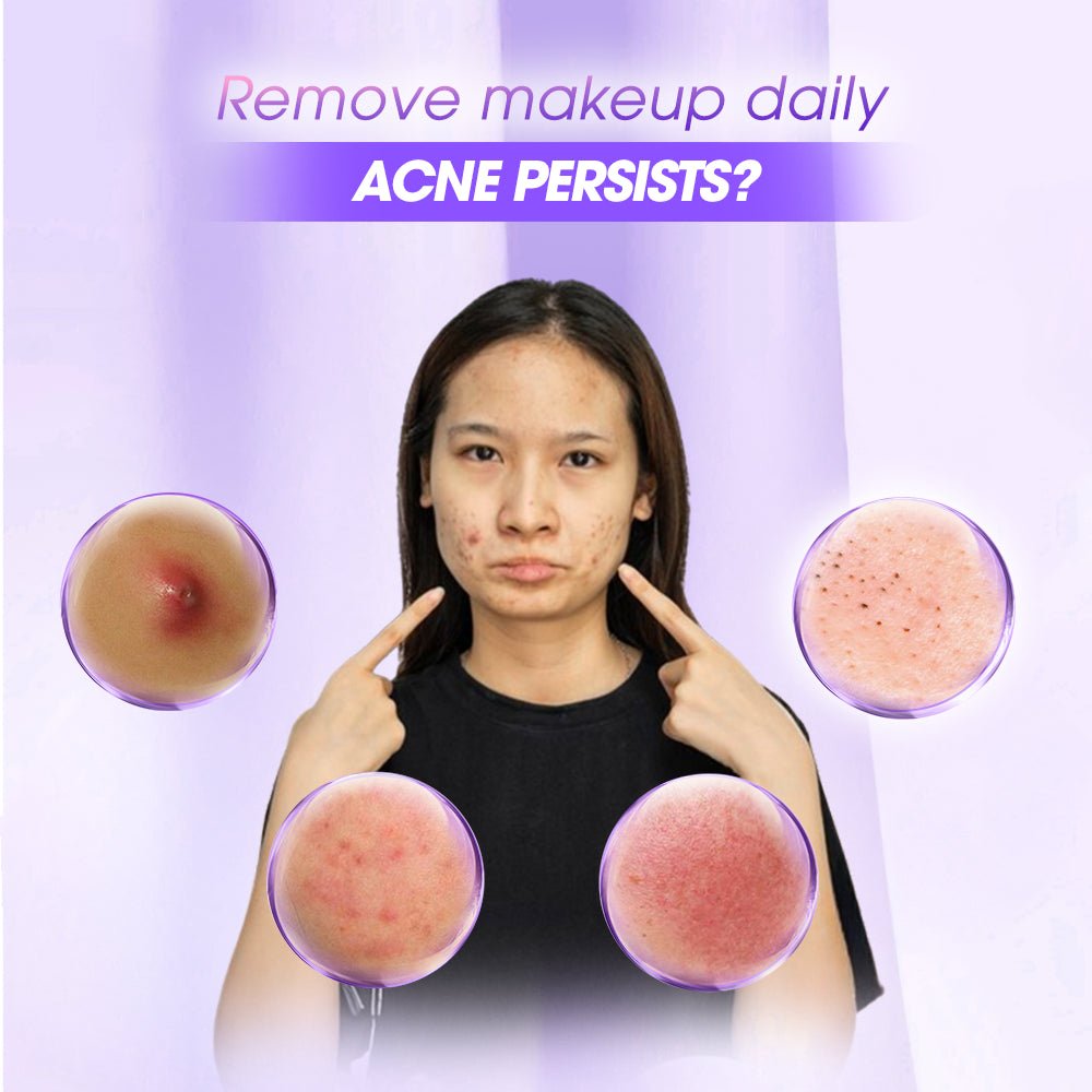 SEYOUL Cleansing Oil - Seyoul - Malaysia OfficialTMDT-1P(0362)