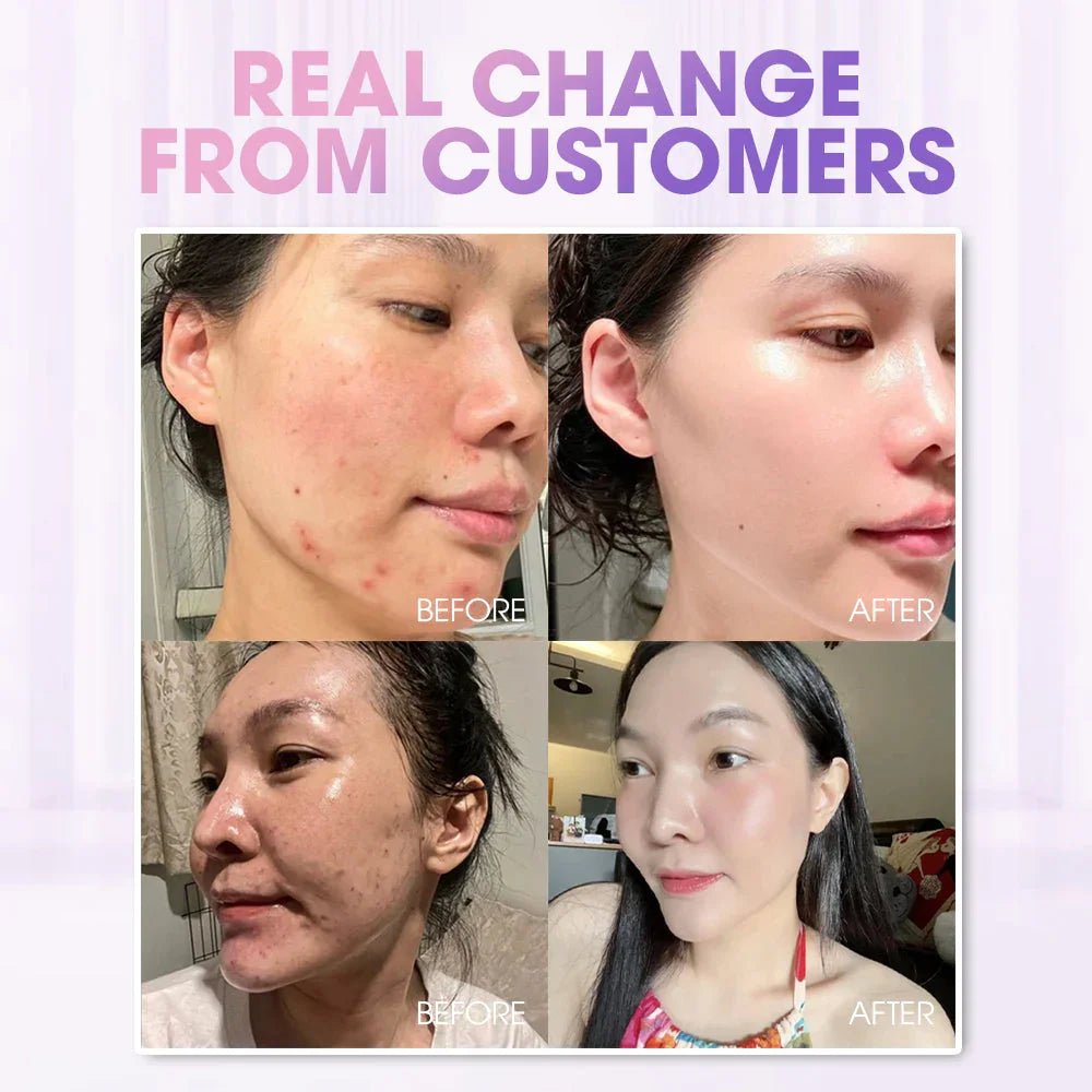 SEYOUL Combo Anti Melasma - Seyoul - Malaysia OfficialTMDT - 1P(0167) - 1P(0496) - 1P(0041)