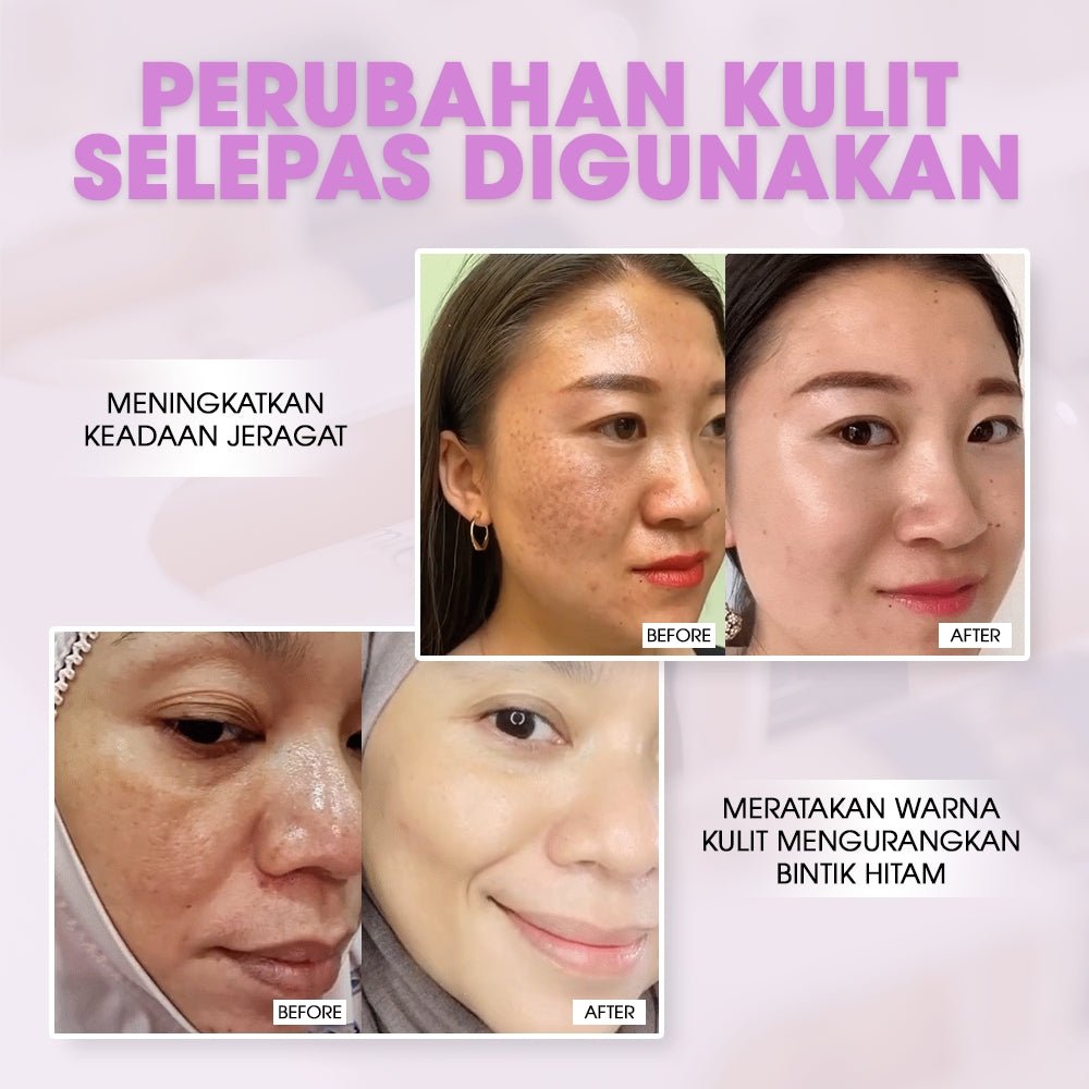 SEYOUL Meso White - Seyoul - Malaysia OfficialTMDT - 1P(0022)