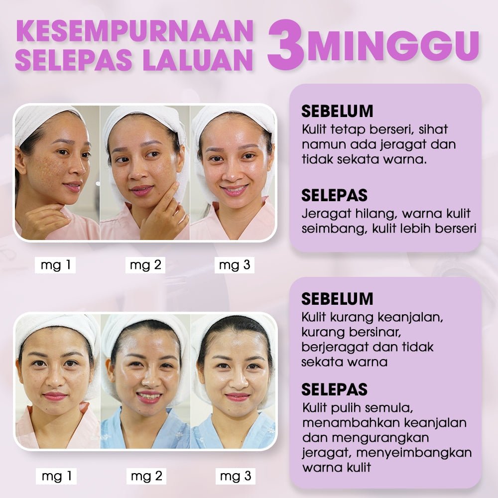 SEYOUL Proclear Pigment Combo - Seyoul - Malaysia OfficialTMDT - 1P(0167) - 1P(0022) - 1P(0004) - 1P(0508)