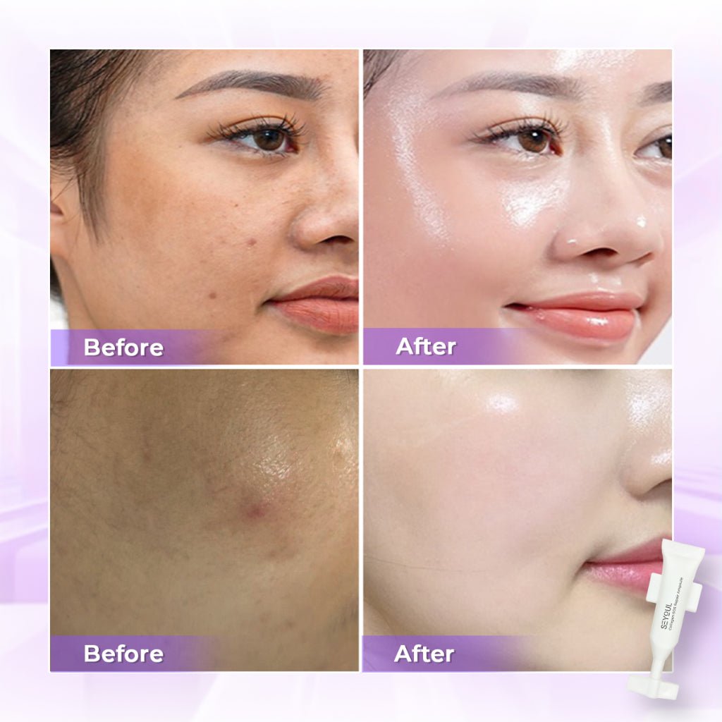 SEYOUL SOS Brightening Ampoule - Seyoul - Malaysia OfficialTMDT - 1P(0417)