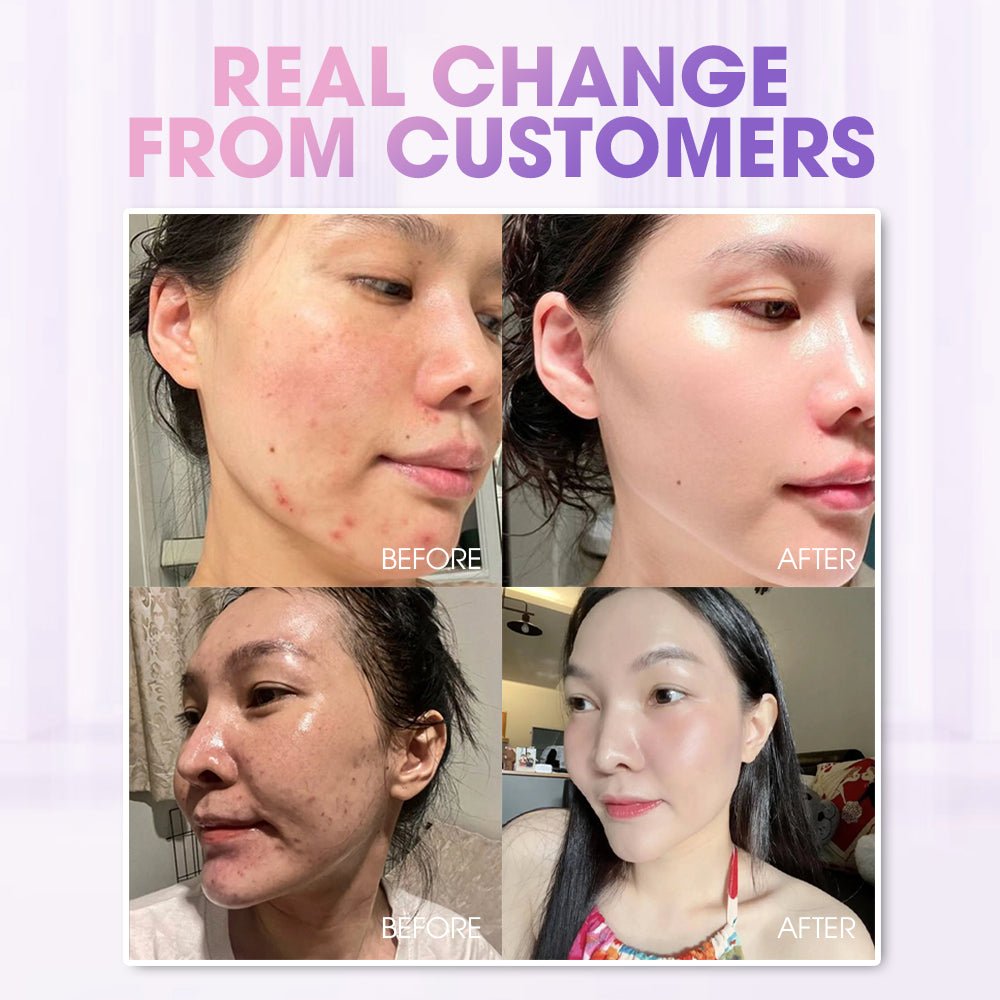 SEYOUL Toner Pad - Seyoul - Malaysia OfficialTMDT - 1P(0496)